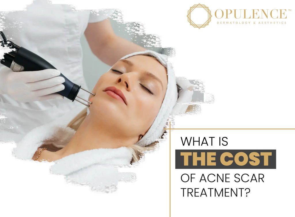 WHAT IS THE COST OF ACNE SCAR TREATMENT? Opulence Dermatologist